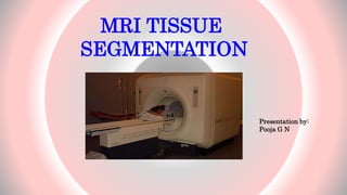 MRI TISSUE
SEGMENTATION
1
Presentation by:
Pooja G N
 