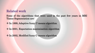 Related work
Some of the algorithms that were used in the past few years in MRI
Tissue Segmentation are:
 In 1999, Adaptive fuzzy C-means algorithm
 In 2001, Expectation maximization algorithm
 In 2002, Modified fuzzy C-means algorithm
12
 