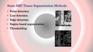 Some MRI Tissue Segmentation Methods
• Point detection
• Line detection
• Edge detection
• Region based segmentation
• Thresholding
8
 