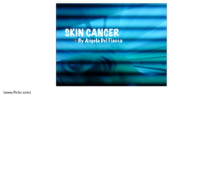 SKIN CANCER
                   !   By Angela Del Fiacco




(www.ﬂickr.com)
 