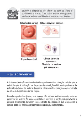 Quando o diagnóstico de câncer do colo do útero é
                 confirmado, é preciso fazer outros exames que ajudam a
                 avaliar se a doença está limitada ou não ao colo do útero.

              Colo uterino normal Células cervicais normais




               Displasia cervical         Células cervicais
                                             cancerosas
                                        Displasia cervical ou
                                           pré-cancerosas


5. Qual é o tratamento?


O tratamento do câncer do colo do útero pode combinar cirurgia, radioterapia e
quimioterapia. A indicação vai depender das condições clínicas da paciente e da
extensão do tumor. Na maioria dos casos, o tratamento é cirúrgico, com a retirada
do útero e da parte interior da vagina.

Quando a paciente é jovem, se a doença não estiver muito avançada, tenta-se
preservar os ovários. Se a doença está bem no início, a opção mais provável é a
cirurgia de remoção do tumor. E dependendo do estágio em que se encontre o
câncer, pode ser necessário fazer radioterapia e/ou quimioterapia.



                                                                                    5
 
