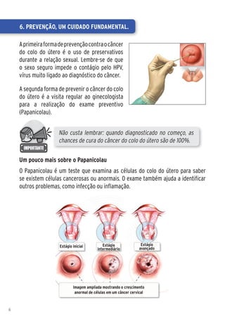 6. Prevenção, um cuidado fundamental.

    A primeira forma de prevenção contra o câncer
    do colo do útero é o uso de preservativos
    durante a relação sexual. Lembre-se de que
    o sexo seguro impede o contágio pelo HPV,
    vírus muito ligado ao diagnóstico do câncer.

    A segunda forma de prevenir o câncer do colo
    do útero é a visita regular ao ginecologista
    para a realização do exame preventivo
    (Papanicolau).


                     Não custa lembrar: quando diagnosticado no começo, as
                     chances de cura do câncer do colo do útero são de 100%.

    Um pouco mais sobre o Papanicolau
    O Papanicolau é um teste que examina as células do colo do útero para saber
    se existem células cancerosas ou anormais. O exame também ajuda a identificar
    outros problemas, como infecção ou inflamação.




                     Estágio inicial          Estágio               Estágio
                                           intermediário           avançado




                             Imagem ampliada mostrando o crescimento
                              anormal de células em um câncer cervical



6
 