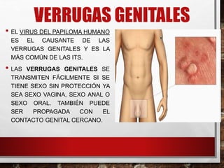 VERRUGAS GENITALES
• EL VIRUS DEL PAPILOMA HUMANO
ES EL CAUSANTE DE LAS
VERRUGAS GENITALES Y ES LA
MÁS COMÚN DE LAS ITS.
• LAS VERRUGAS GENITALES SE
TRANSMITEN FÁCILMENTE SI SE
TIENE SEXO SIN PROTECCIÓN YA
SEA SEXO VAGINA, SEXO ANAL O
SEXO ORAL. TAMBIÉN PUEDE
SER PROPAGADA CON EL
CONTACTO GENITAL CERCANO.
 