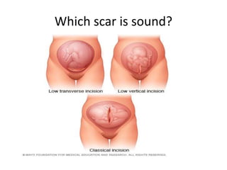 Which scar is sound?
