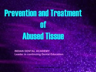 Prevention and Treatment
of
Abused Tissue
INDIAN DENTAL ACADEMY
Leader in continuing Dental Education
www.indiandentalacademy.com
 