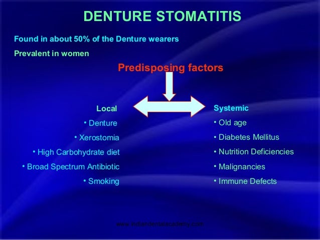 preventing denture stomatitis Denture stomatitis is a common oral mucosal lesion in the deterrence/prevention denture sanitization is an important element in the treatment of denture. preventing denture stomatitis Denture stomatitis is a common oral mucosal lesion in the deterrence/prevention denture sanitization is an important element in the treatment of denture.