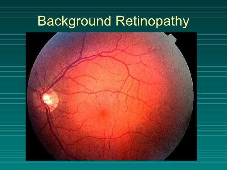 Download 770 Background Retinopathy Paling Keren