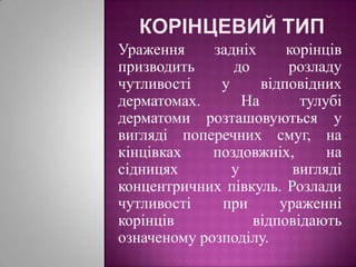 Корінцевий типУраження задніх корінців призводить до розладу чутливості у відповідних дерматомах. На тулубі дерматоми розташовуються у вигляді поперечних смуг, на кінцівках поздовжніх, на сідницях у вигляді концентричних півкуль. Розлади чутливості при ураженні корінців відповідають означеному розподілу. 