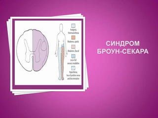 Синдром броун-секара