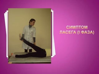 Симптом ласега (І фаза)