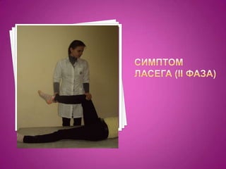 Симптом ласега (ІІ фаза)