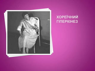 Хореїчний гіперкінез