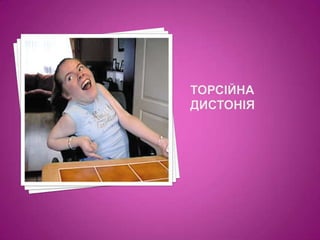 торсійна дистонія