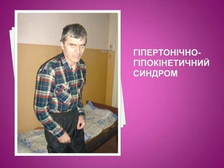 гіпертонічно-гіпокінетичний синдром 