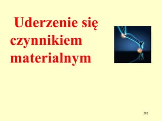 Uderzenie się
czynnikiem
materialnym


                 282
 