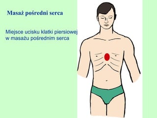 Masaż pośredni serca


Miejsce ucisku klatki piersiowej
w masażu pośrednim serca
 