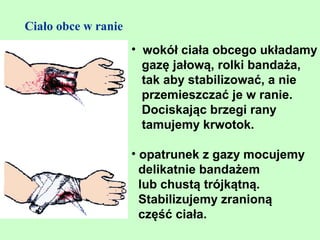 Ciało obce w ranie
                     • wokół ciała obcego układamy
                       gazę jałową, rolki bandaża,
                       tak aby stabilizować, a nie
                       przemieszczać je w ranie.
                       Dociskając brzegi rany
                       tamujemy krwotok.

                     • opatrunek z gazy mocujemy
                       delikatnie bandażem
                       lub chustą trójkątną.
                       Stabilizujemy zranioną
                       część ciała.
 