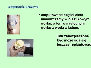 Amputacja urazowa

                    • amputowane części ciała
                      umieszczamy w plastikowym
                      worku, a ten w następnym
                      worku z wodą z lodem.

                             Tak zabezpieczone
                             być może uda się
                             jeszcze replantować
 