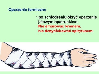 Oparzenie termiczne
             • po schłodzeniu okryć oparzenie
               jałowym opatrunkiem.
               Nie smarować kremem,
               nie dezynfekować spirytusem.
 