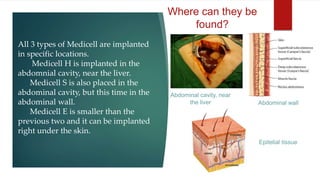 All 3 types of Medicell are implanted
in specific locations.
Medicell H is implanted in the
abdomnial cavity, near the liver.
Medicell S is also placed in the
abdominal cavity, but this time in the
abdominal wall.
Medicell E is smaller than the
previous two and it can be implanted
right under the skin.
Where can they be
found?
Abdominal wall
Abdominal cavity, near
the liver
Epitelial tissue
 