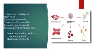 There are several types of
stem cells:
Embryonic stem cells ;
Tissue-specific stem cells ;
Mesenchymal stem cells ;
Induced pluripotent stem cells.
In our presentation, we have
chosen to use induced
pluripotent stem cells.
 