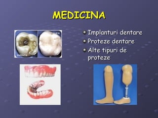 MEDICINAMEDICINA
Implanturi dentareImplanturi dentare
Proteze dentareProteze dentare
Alte tipuri deAlte tipuri de
protezeproteze
 