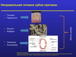 Неправильная гигиена зубов причина:


  •   Гингивит
  •   Пародонтит




                                                                                                                                         Менять дизайн
  •   Инсульт
  •   Инфаркт




  •   Ожирение
  •   Альцгеймер


                2005 Feb 8;111(5):576-82.
                Periodontal microbiota and carotid intima-media thickness: the Oral Infections and Vascular Disease Epidemiology Study (INVEST).
                Desvarieux M, Demmer RT, Rundek T, Boden-Albala B, Jacobs DR Jr, Sacco RL, Papapanou PN.
 