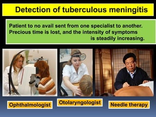 Comprehensive Overview of Tuberculous Meningitis: Diagnosis, Clinical ...