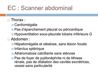 EC : Scanner abdominal
 Thorax :
 Cardiomégalie
 Pas d’épanchement pleural ou péricardique
 Hypoventilation sous-pleurale lobaire inférieure G
 Abdomen :
 Hépatomégalie et stéatose, sans lésion focale
 Infarctus splénique
 Athéromatose calcifiante sans sténose
 Pas de foyer de pyélonéphrite ni de lithiase
rénale, pas de dilatation des cavités excrétrices,
vessie sans particularité
 
