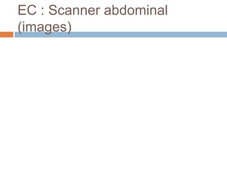EC : Scanner abdominal
(images)
 
