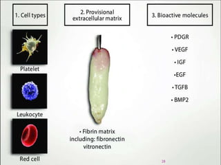 PLATELET RICH FIBRIN - ROLE IN PERIODONTICS | PPTX