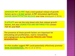PLATELET RICH FIBRIN - ROLE IN PERIODONTICS | PPTX
