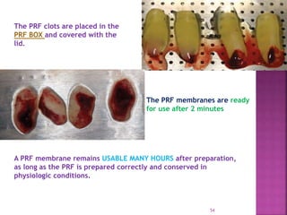 PLATELET RICH FIBRIN - ROLE IN PERIODONTICS | PPTX
