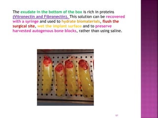 PLATELET RICH FIBRIN - ROLE IN PERIODONTICS | PPTX