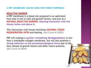 PLATELET RICH FIBRIN - ROLE IN PERIODONTICS | PPTX
