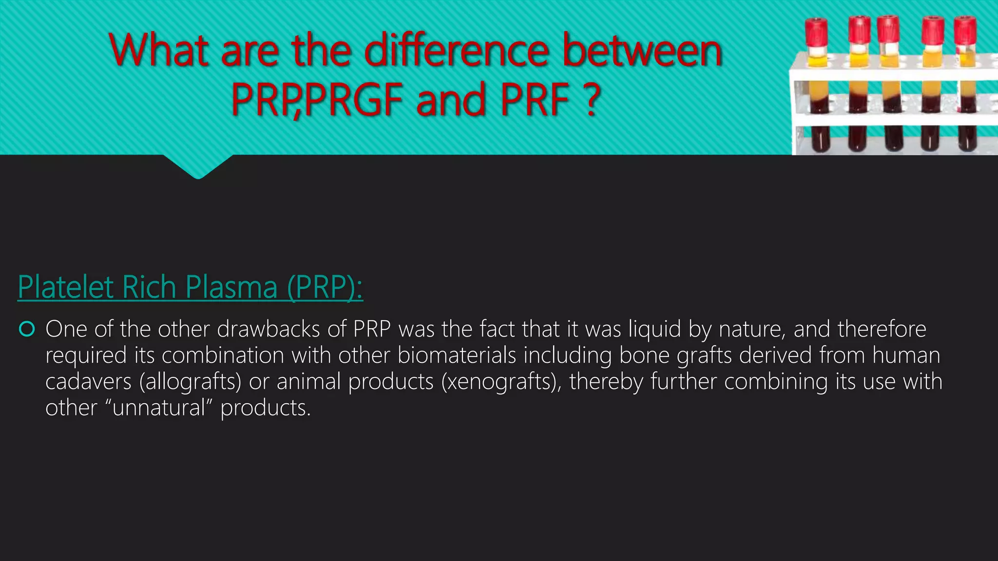 Platelet Rich Fibrin (PRF) in Dentistry | PPTX