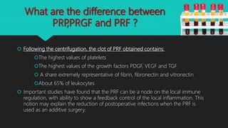 Platelet Rich Fibrin (PRF) in Dentistry | PPTX