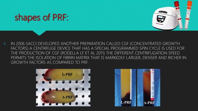 Platelet Rich Fibrin (PRF) in Dentistry | PPTX