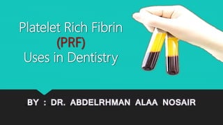 Platelet Rich Fibrin
(PRF)
Uses in Dentistry
BY : DR. ABDELRHMAN ALAA NOSAIR
 