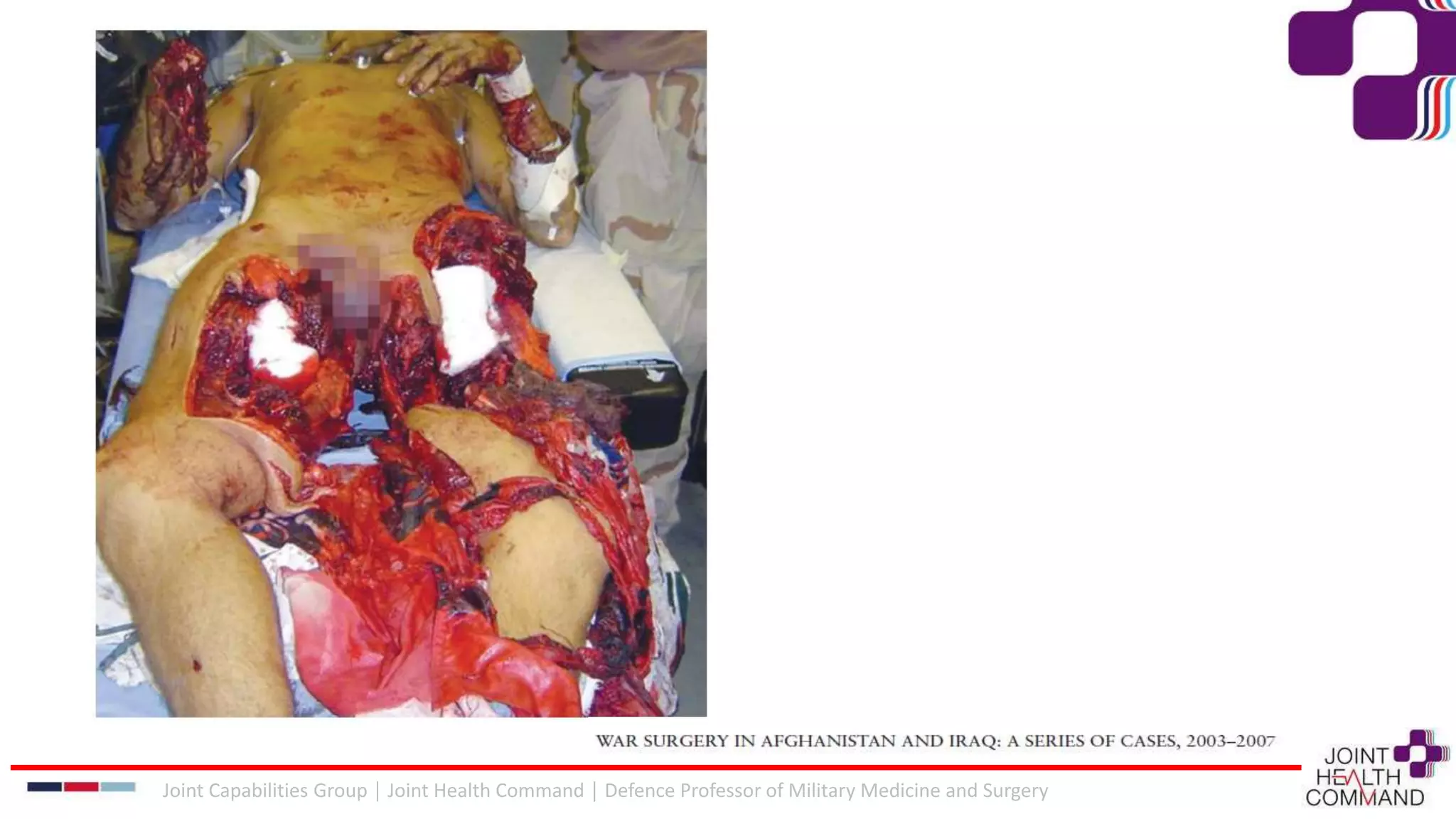 Joint Capabilities Group │ Joint Health Command │ Defence Professor of Military Medicine and Surgery
 