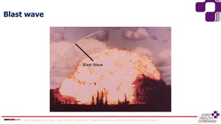 Joint Capabilities Group │ Joint Health Command │ Defence Professor of Military Medicine and Surgery
Blast wave
 