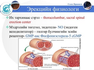 Priapism (Приапизм) | PPT