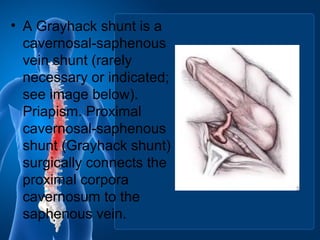 • A Grayhack shunt is a
cavernosal-saphenous
vein shunt (rarely
necessary or indicated;
see image below).
Priapism. Proximal
cavernosal-saphenous
shunt (Grayhack shunt)
surgically connects the
proximal corpora
cavernosum to the
saphenous vein.
 