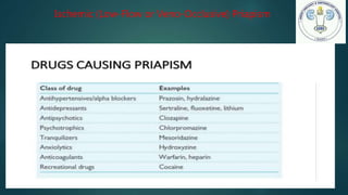 Ischemic (Low-Flow or Veno-Occlusive) Priapism
 