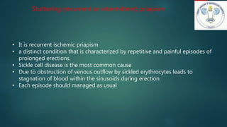 Stuttering (recurrent or intermittent) priapism
• It is recurrent ischemic priapism
• a distinct condition that is characterized by repetitive and painful episodes of
prolonged erections.
• Sickle cell disease is the most common cause
• Due to obstruction of venous outflow by sickled erythrocytes leads to
stagnation of blood within the sinusoids during erection
• Each episode should managed as usual
 