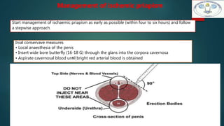 Start management of ischaemic priapism as early as possible (within four to six hours) and follow
a stepwise approach.
Inial conservave measures
• Local anaesthesia of the penis
• Insert wide bore butterfly (16-18 G) through the glans into the corpora cavernosa
• Aspirate cavernosal blood un•til bright red arterial blood is obtained
Management of ischemic priapism
 