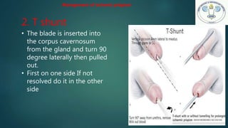 2. T shunt
• The blade is inserted into
the corpus cavernosum
from the gland and turn 90
degree laterally then pulled
out.
• First on one side If not
resolved do it in the other
side
Management of ischemic priapism
 