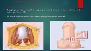 1.Corporo spongiosum shunt
• Through apernial incision or penile the corpus sponisum and corpus cavernousum are incised and
anastomosed on one side
• The more proximal the less urethral fistula as spongiusm thick more proximally.
Management of ischemic priapism
 