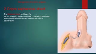 2.Copro saphenous shunt
The Grayhack shunt mobilizes the
saphenous vein below the junction of the femoral vein and
anastamoses the vein end to side into the corpus
cavernosum.
Management of ischemic priapism
 