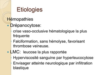 Etiologies Hémopathies Drépanocytose: crise vaso-occlusive hématologique la plus fréquenteFalciformation, sans hémolyse, favorisant thrombose veineuse.LMC:  leucose la plus rapportéeHyperviscosité sanguine par hyperleucocytoseEnvisager atteinte neurologique par infiltration blastique